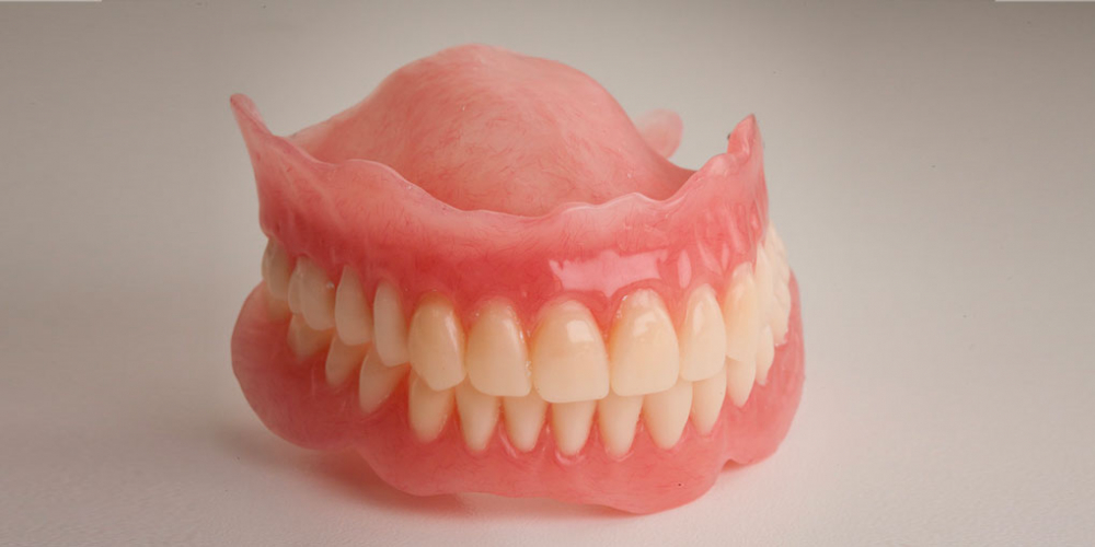  Восстановление прикуса полными съемными протезами при отсутствии всех зубов